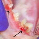 forl, feline oral resorptive lesion
